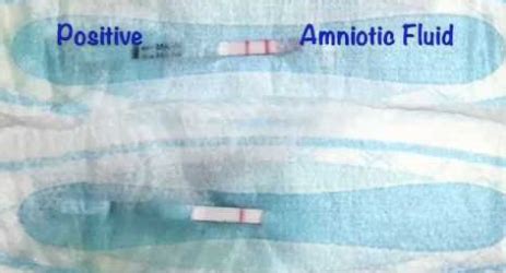 how to know if amniotic fluid is leaking|Leaking Amniotic Fluid: Signs in 1st to 3rd Trimester